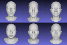 北京联合丽格第一医院罗金超教授：3D人脸重建技术的发展与展望